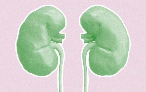 Featured image for post: It’s Time to Pay Kidney Donors